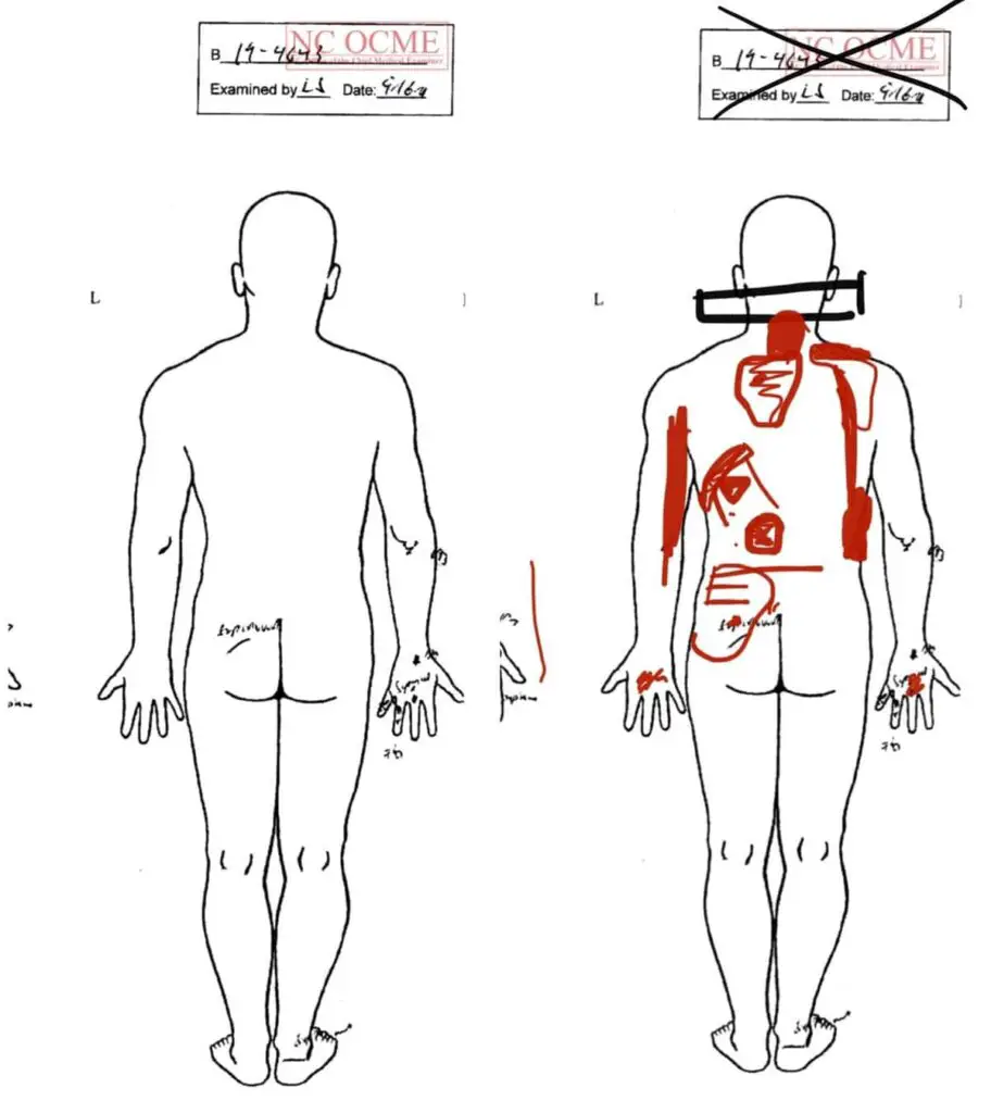 Brandon Embry: autopsy diagram of injuries